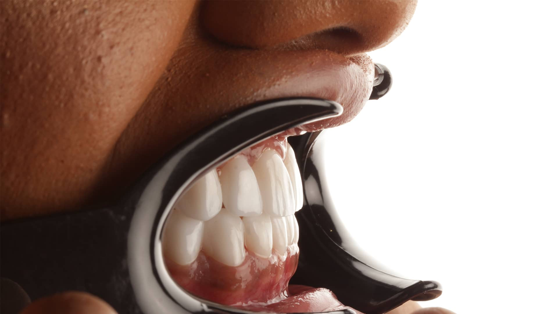 Zirkonyum Altyapılı Porselen